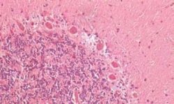 ATG16L1 Antibody, Novus Biologicals 50 &mu;g | Buy Online | Novus Biologicals | Fisher Scientific